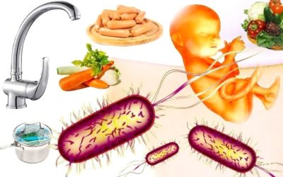 Listeria negli alimenti: un batterio che può uccidere listeria slider 400x250 1 - Listeria negli alimenti: un batterio che può uccidere