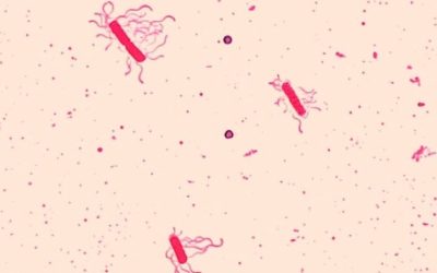 Bacillus Cereus: ecco il responsabile di tantissime infezioni alimentari - ricette-vegane-dal-web - image 6 400x250 - image 6 400x250 - Bacillus Cereus: ecco il responsabile di tantissime infezioni alimentari - ricette-vegane-dal-web-